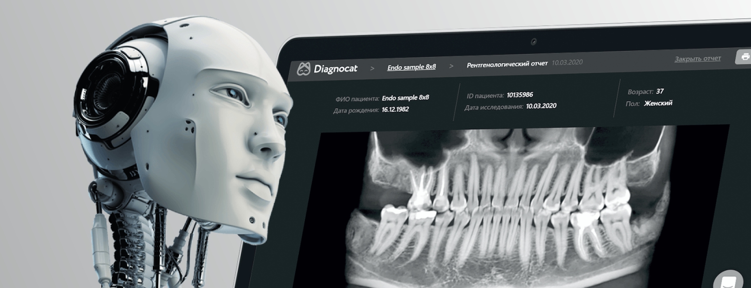 Комплексное стоматологическое обследование с использованием искусственного интеллекта Diagnocat -  5000 ₽